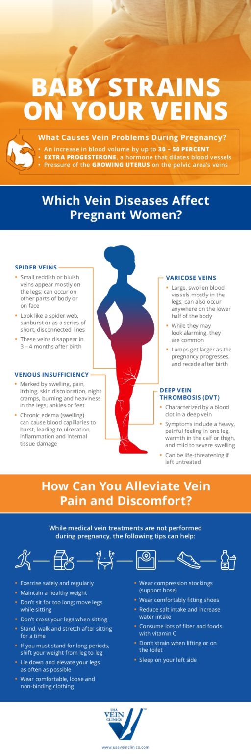 Vein Disease Pregnancy Care Center of Chandler